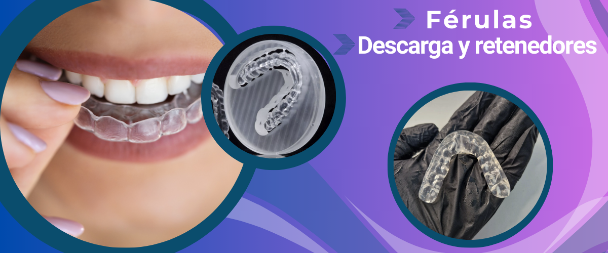 magen trabajo férulas de descarga y retenedores , inspira dental laboratorio